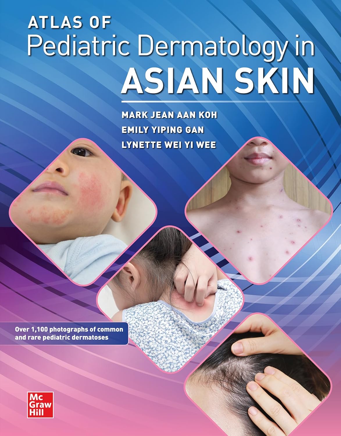 Atlas of Pediatric Dermatology in Asian Skin 1st Edition