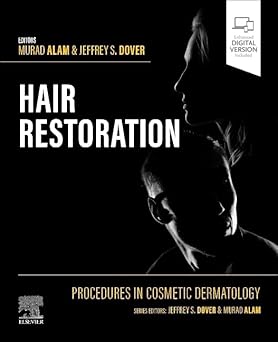 Procedures in Cosmetic Dermatology: Hair Restoration 1st Edition