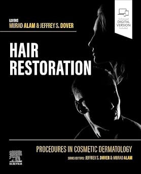Procedures in Cosmetic Dermatology: Hair Restoration 1st Edition