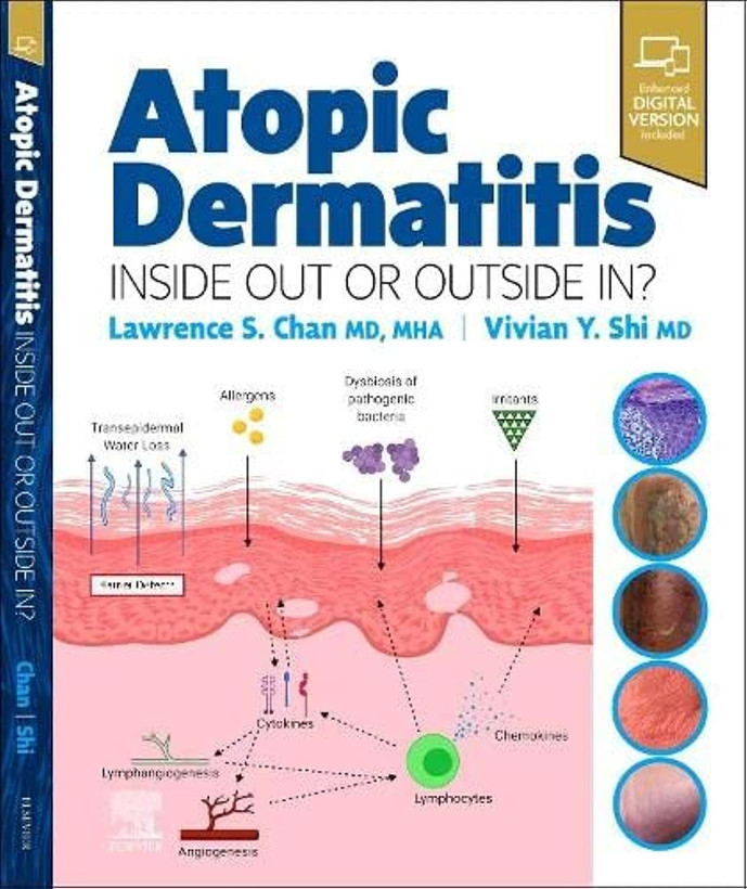 Atopic Dermatitis: Inside Out or Outside In